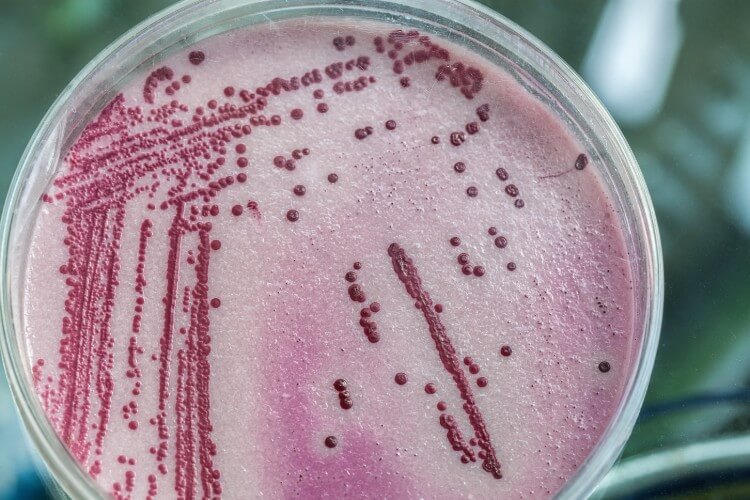 petri dish with bacteria growth
